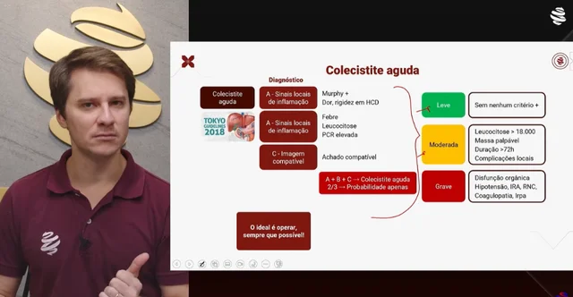 Cirurgia Geral - Colecistite Aguda